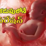 Baby heart surgery : చిన్నారి గుండెకు అరుదైన శస్త్ర చికిత్స.. హైదరాబాద్ వైద్యుల ఘనత..