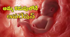 Baby heart surgery : చిన్నారి గుండెకు అరుదైన శస్త్ర చికిత్స.. హైదరాబాద్ వైద్యుల ఘనత..