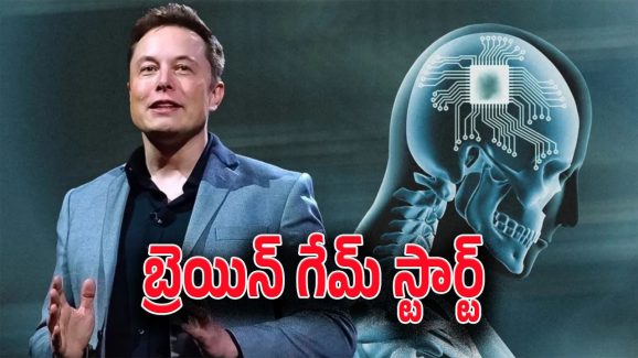 Elon Musk’s Neuralink : హ్యూమన్ కంప్యూటింగ్ లో మరో మైలురాయి