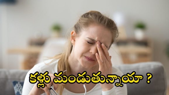 Burning Eyes: కళ్లు మండుతున్నాయా ? జాగ్రత్త, అస్సలు లైట్ తీసుకోవద్దు