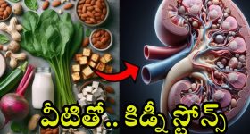 Kidney Stones: మీరూ ఈ కూరగాయలు తింటున్నారా ? అయితే కిడ్నీ స్టోన్స్ గ్యారంటీ