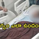 Sri Tej Health: అవి ఇవ్వడం ఆపేశాం.. శ్రీ తేజ్ హెల్త్ బులెటిన్ విడుదల