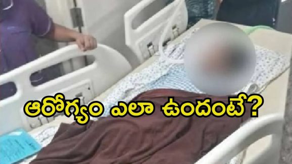 Sri Tej Health: అవి ఇవ్వడం ఆపేశాం.. శ్రీ తేజ్ హెల్త్ బులెటిన్ విడుదల