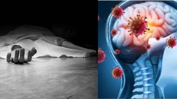 Guillain-Barre Syndrome Death : దేశంలో మరో మహమ్మారి.. వేగంగా పెరుగుతున్న కేసులు.. మహారాష్ట్రలో ఒకరు మృతి!