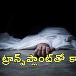 Liver Transplant Patient Dead : లివర్ మార్పిడి ఆపరేషన్ జరిగిన పేషెంట్ మృతి.. డోనర్ ద్వారా సోకిన క్యాన్సర్!
