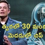 Elon Musk Neura Link Chip: మూడో వ్యక్తి మెదుడులో న్యూరాలింక్ చిప్.. త్వరలో 30 మందికి అమరుస్తాం.. మస్క్ ప్రకటన