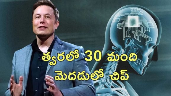 Elon Musk Neura Link Chip: మూడో వ్యక్తి మెదుడులో న్యూరాలింక్ చిప్.. త్వరలో 30 మందికి అమరుస్తాం.. మస్క్ ప్రకటన