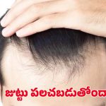 Hair Fall: రోజు రోజుకు జుట్టు పలచబడుతోందా ? ఇలా చేస్తే.. ప్రాబ్లమ్ సాల్వ్