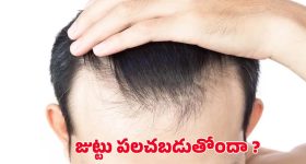 Hair Fall: రోజు రోజుకు జుట్టు పలచబడుతోందా ? ఇలా చేస్తే.. ప్రాబ్లమ్ సాల్వ్