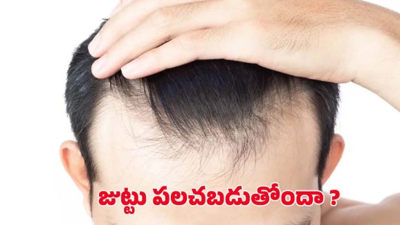 Hair Fall: రోజు రోజుకు జుట్టు పలచబడుతోందా ? ఇలా చేస్తే.. ప్రాబ్లమ్ సాల్వ్