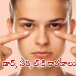 Dark Circles: డార్క్ సర్కిల్స్ రావడానికి గల కారణాలివే !