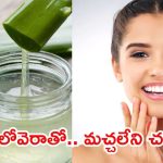 Face Pack For Dark Spots: అలోవెరాను ఇలా వాడితే.. ముఖంపై నల్లమచ్చలు మాయం