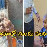 Maharashstra Villages Baldness: గ్రామస్తులందరికీ ఊడిపోతున్న జుట్టు.. ఆ మూడు గ్రామాల్లో వింత వ్యాధి వ్యాప్తి!?