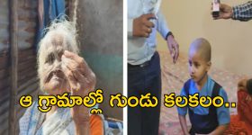 Maharashstra Villages Baldness: గ్రామస్తులందరికీ ఊడిపోతున్న జుట్టు.. ఆ మూడు గ్రామాల్లో వింత వ్యాధి వ్యాప్తి!?