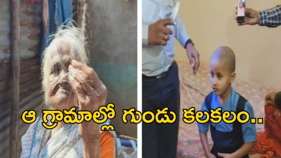 Maharashstra Villages Baldness: గ్రామస్తులందరికీ ఊడిపోతున్న జుట్టు.. ఆ మూడు గ్రామాల్లో వింత వ్యాధి వ్యాప్తి!?