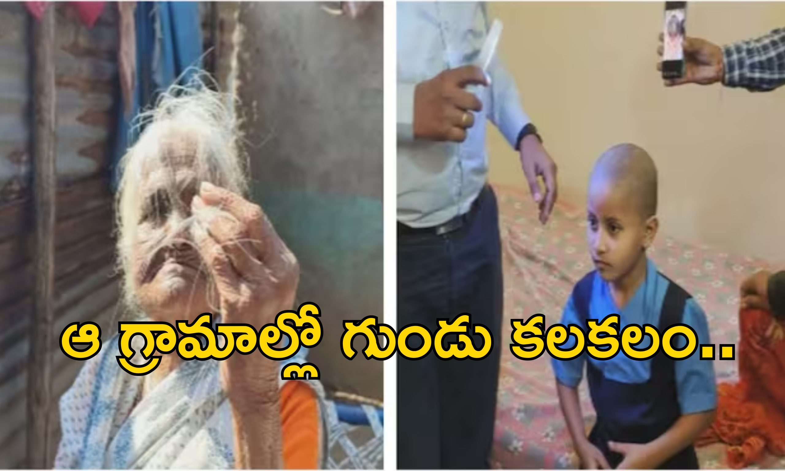 Maharashstra Villages Baldness: గ్రామస్తులందరికీ ఊడిపోతున్న జుట్టు.. ఆ మూడు గ్రామాల్లో వింత వ్యాధి వ్యాప్తి!?