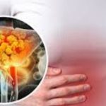 Fatty Liver Symptoms: మీలో ఈ లక్షణాలు ఉన్నాయా ? ఫ్యాటీ లివర్ కావొచ్చు.. జాగ్రత్త !