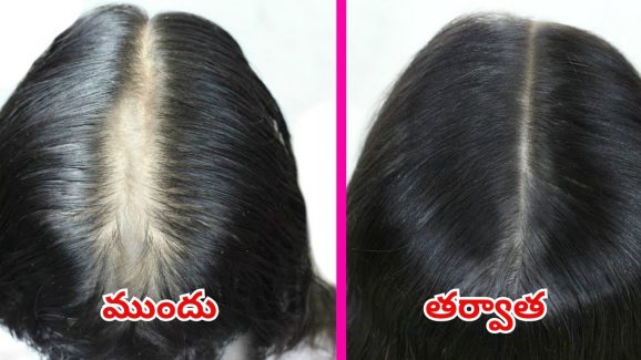 Hair Growth Tips: జుట్టు పెరగాలా ? అయితే ఈ టిప్స్ మీ కోసమే