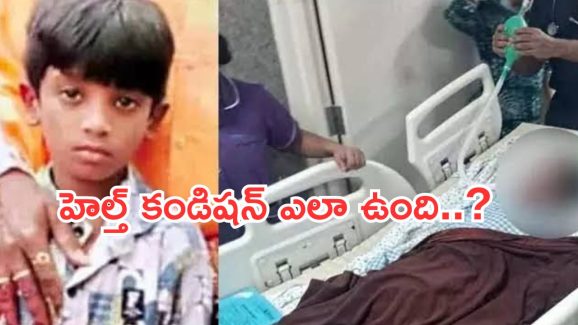 Sri Tej Health Update : శ్రీ తేజ్ పూర్తిగా కోలుకున్నాడా? డాక్టర్లు ఏం అన్నారంటే..?