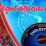 High Cholesterol: చెడు కొలెస్ట్రాల్‌ను ఐస్‌లా తగ్గించే.. బెస్ట్ టిప్స్ ఇవే !