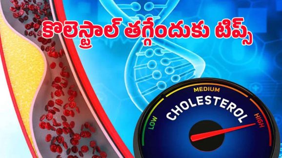 High Cholesterol: చెడు కొలెస్ట్రాల్‌ను ఐస్‌లా తగ్గించే.. బెస్ట్ టిప్స్ ఇవే !