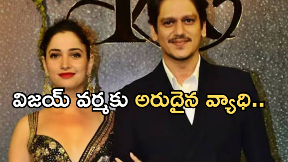 Tamannaah Bhatia : అరుదైన వ్యాధితో బాధపడుతున్న తమన్నా బాయ్ ఫ్రెండ్…