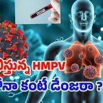 HMPV Symptoms: వణుకుపుట్టిస్తున్న HMPV.. కరోనా కంటే డేంజరా ? లక్షణాలివే !