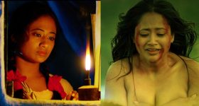 Doctor removes: కంగుతిన్న డాక్టర్లు.. బాలుడి ముక్కులో పాము తోక.. బయటకు లాగితే..