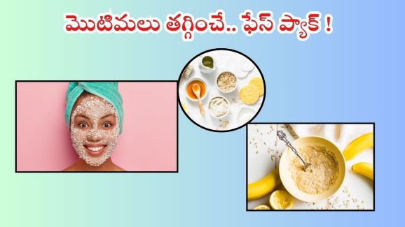Oats Face Pack: మొటిమలు వేధిస్తున్నాయా ? ఈ ఫేస్ ప్యాక్స్ ట్రై చేయండి