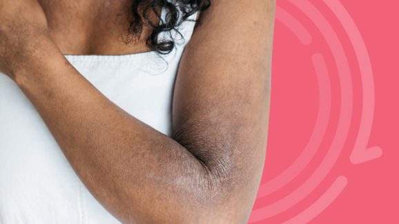 Skin Colour: మన శరీరంలోని ఆ భాగాలు నల్లగా ఎందుకు ఉంటాయో తెలుసా?