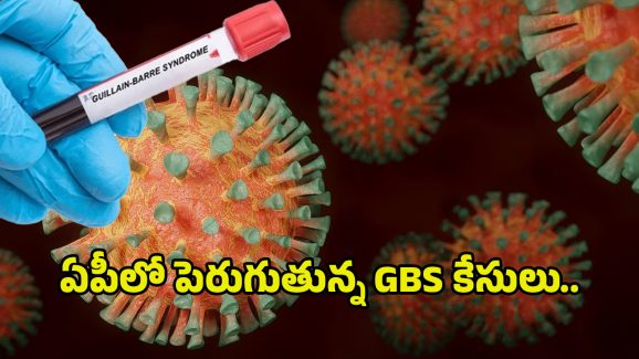 GBS Virus In AP: ఏపీలో రోజు రోజుకి పెరుగుతున్న GBS కేసులు.. ఆందోళనలో ప్రజలు
