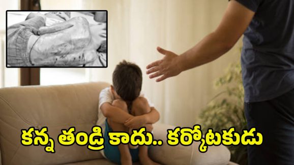 Jaggareddy Gudem News: అమానుష ఘటన.. కొడుకును చిత్రహింసలు పెట్టిన తండ్రి