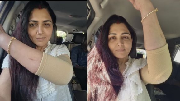 Khushboo: ప్రముఖ నటి ఖుష్బూకి గాయాలు.. ఆందోళనలో అభిమానులు..!