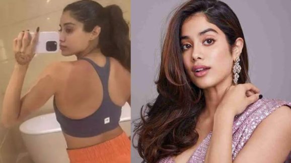 Janvi Kapoor : ఎర్రగా బొబ్బలెక్కిన జాన్వీ బాడీ.. అసలేమైంది?