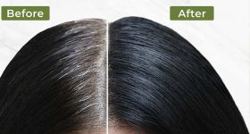 White Hair Remedies: చిన్న వయస్సులోనే తెల్ల జుట్టు సమస్యా ? ఇలా చేస్తే.. సమస్య దూరం