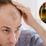 Bald Head: ఆముదంలో ఈ ఒక్కటి కలిపి వాడితే.. జన్మలో బట్ట తల రాదు