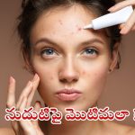 Pimple Problem: నుదుటిపై మొటిమలు ఎందుకు వస్తాయ్ ?