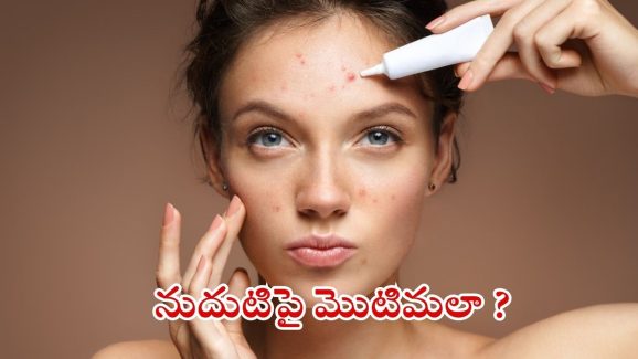 Pimple Problem: నుదుటిపై మొటిమలు ఎందుకు వస్తాయ్ ?