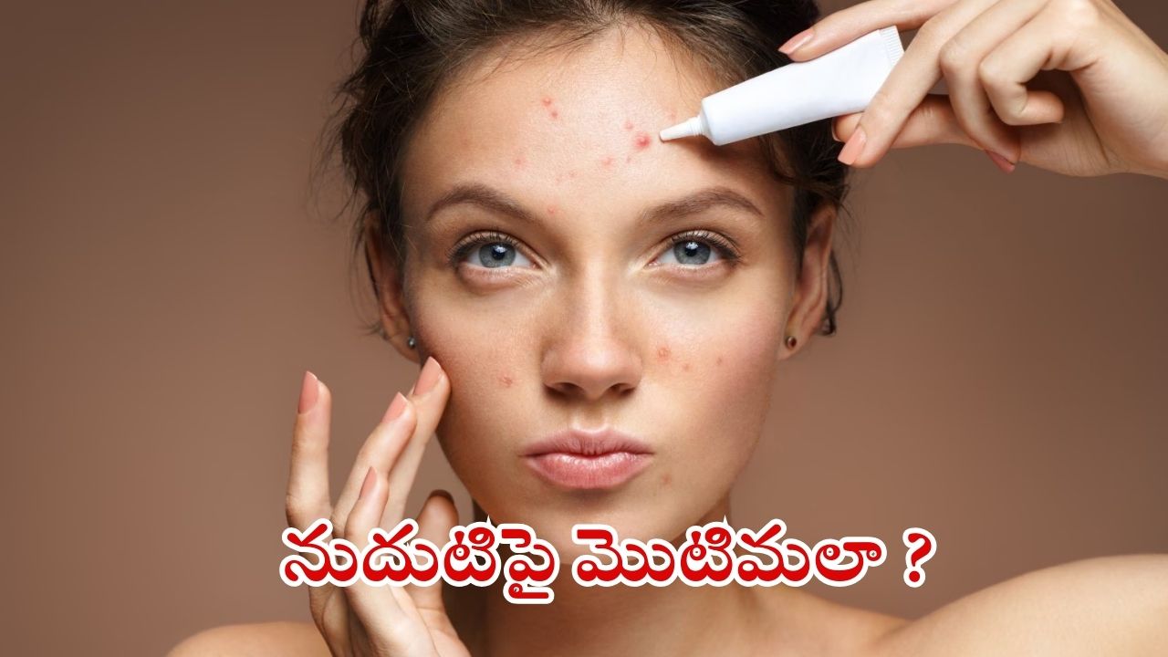 Pimple Problem: నుదుటిపై మొటిమలు ఎందుకు వస్తాయ్ ?