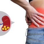 Kidney Stones: కిడ్నీలో రాళ్లు ఏర్పడకుండా ఉండాలంటే.. ఏం చేయాలి ?