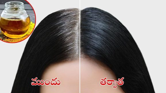 White Hair Remedies: ఆవ నూనెలో ఈ రెండు కలిపి వాడితే.. తెల్ల జుట్టు రమ్మన్నా రాదు