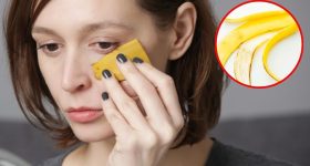 Banana Peel For Skin: అరటి తొక్కను ఇలా వాడితే.. గ్లోయింగ్ స్కిన్ పక్కా !