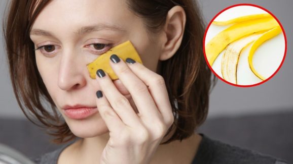 Banana Peel For Skin: అరటి తొక్కను ఇలా వాడితే.. గ్లోయింగ్ స్కిన్ పక్కా !