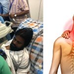 Pawan Kalyan: డిప్యూటీ సీఎం పవన్ కళ్యాణ్ కు అరుదైన వ్యాధి.. ముదిరితే పక్షవాతం.. ?
