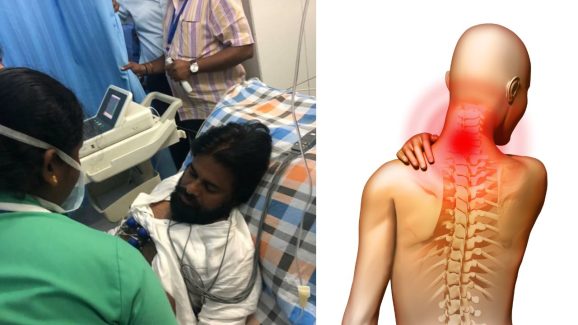 Pawan Kalyan: డిప్యూటీ సీఎం పవన్ కళ్యాణ్ కు అరుదైన వ్యాధి.. ముదిరితే పక్షవాతం.. ?