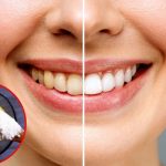 Teeth Whitening: పళ్లు పసుపు రంగులోకి మారాయా ? ఈ టిప్స్ మీ కోసమే !