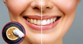 Teeth Whitening: పళ్లు పసుపు రంగులోకి మారాయా ? ఈ టిప్స్ మీ కోసమే !