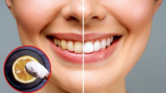 Teeth Whitening: పళ్లు పసుపు రంగులోకి మారాయా ? ఈ టిప్స్ మీ కోసమే !
