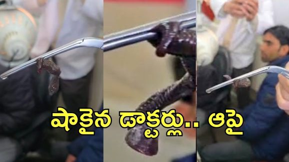 Doctor removes: కంగుతిన్న డాక్టర్లు.. బాలుడి ముక్కులో పాము తోక.. బయటకు లాగితే..