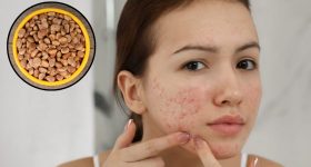 Chironji For Skin: చిరోంజిని ఇలా వాడితే.. ముఖంపై ఒక్క మచ్చ కూడా ఉండదు